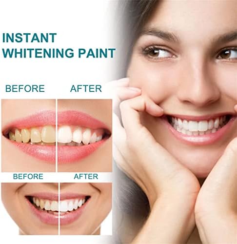 Boja zuba, Trenutna boja za izbjeljivanje zuba, Poljski zub UPTIGN White 15ml